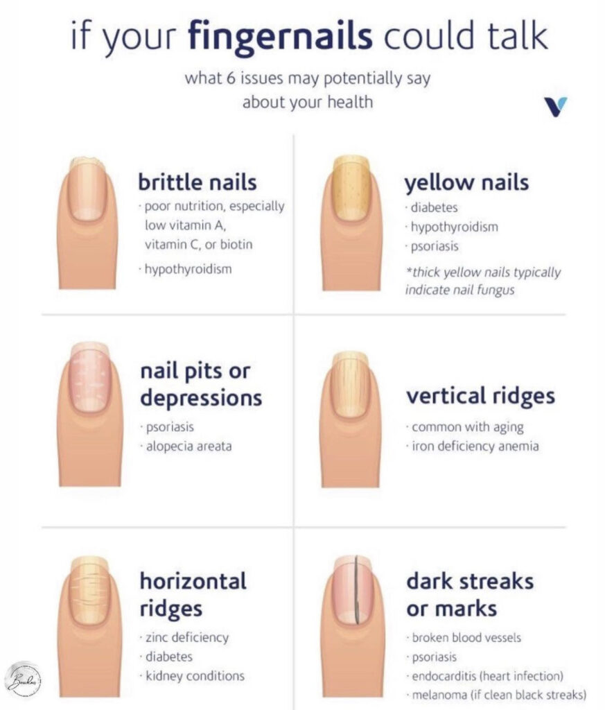 What your nails reveal about your health | Shine365 from Marshfield Clinic